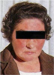 Faţă umană